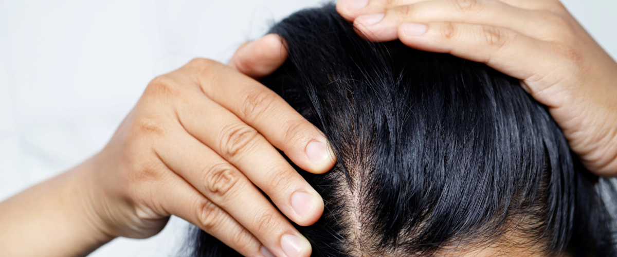 Пілінг для шкіри голови
